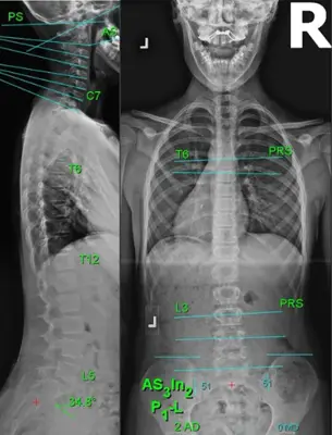 Chiropractic Ewa Beach HI Green X-Ray Chiropractic Ewa Beach HI Green X-Ray
