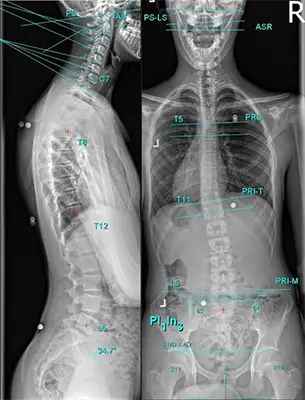 Chiropractic Ewa Beach HI Teal X-Ray Chiropractic Ewa Beach HI Teal X-Ray